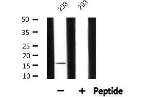 Western blot analysis of extracts from 293, using MRPL14 Antibody. (MRPL14 抗体  (C-Term))