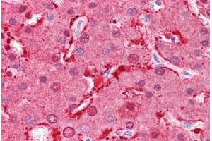 Human Liver: Formalin-Fixed, Paraffin-Embedded (FFPE) (FABP1 抗体  (N-Term))