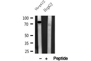 Western blot analysis of extracts of HepG2 cells, using CPT1A antibody. (CPT1A 抗体  (Internal Region))