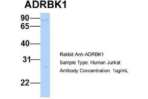 Host: Rabbit Target Name: ADRBK1 Sample Type: Human Jurkat Antibody Dilution: 1.