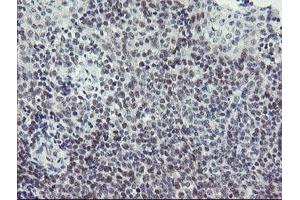 Image no. 4 for anti-SUMO1/sentrin/SMT3 Specific Peptidase 2 (SENP2) (AA 139-523) antibody (ABIN1490931)