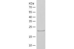 Western Blotting (WB) image for Protein tyrosine Phosphatase, Receptor Type, C (PTPRC) (AA 1031-1251) protein (His tag) (ABIN7124684)
