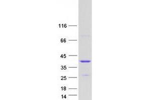 Validation with Western Blot