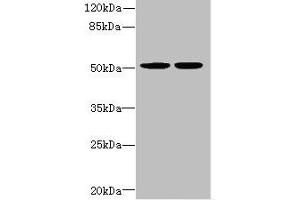 Western blot All lanes: MATK antibody at 5. (MATK 抗体  (AA 393-507))