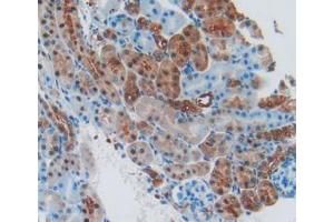 IHC-P analysis of Mouse Kidney Tissue, with DAB staining. (VCAM1 抗体  (AA 116-309))