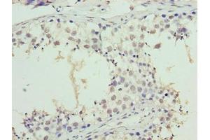 Immunohistochemistry (IHC) image for anti-Synaptojanin 2 Binding Protein (SYNJ2BP) (AA 1-117) antibody (ABIN7171128)