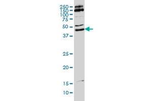 MKRN2 monoclonal antibody (M01), clone 5F8 Western Blot analysis of MKRN2 expression in Hela S3 NE . (MKRN2 抗体  (AA 317-415))