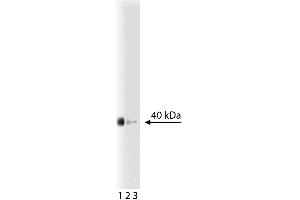 Western blot analysis of prostasin on a LNCaP-FGC-10 (human prostate cancer cell line) lysate. (PRSS8 抗体  (AA 108-228))