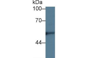 Western blot analysis of Human Hela cell lysate, using Rabbit Anti-Rat KNG1 Antibody (5 µg/ml) and HRP-conjugated Goat Anti-Rabbit antibody (abx400043, 0. (KNG1 抗体  (AA 19-380))