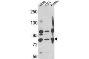 Western blot analysis of Neprilysin Antibody (C-term) in A2058,A375,Ramos cell line lysates (35ug/lane). (MME 抗体  (C-Term))