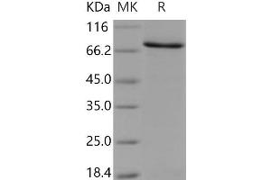 Western Blotting (WB) image for 6-phosphofructo-2-Kinase/fructose-2,6-Biphosphatase 3 (PFKFB3) protein (GST tag,His tag) (ABIN7194084)