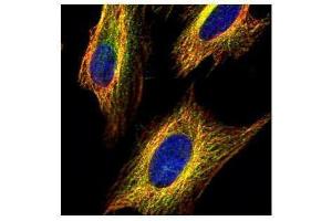 Immunofluorescence (IF) image for anti-Voltage-Dependent Anion Channel 2 (VDAC2) (C-Term) antibody (ABIN2855930)