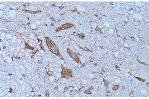 Immunohistochemistry of paraffin-embedded Rat spinal cord using HADH Polyclonal Antibody at dilution of 1:100 (40x lens). (HADH 抗体)