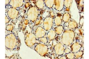Immunohistochemistry of paraffin-embedded human thyroid tissue using ABIN7149332 at dilution of 1:100 (PITPNC1 抗体  (AA 1-268))