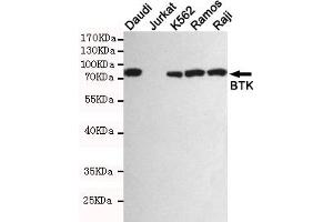 Western blot detection of BTK in Daudi,Jurkat(BTK negative),K562,Ramos and Raji cell lysates using BTK mouse mAb (1:1000 diluted). (BTK 抗体)
