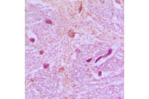 Immunohistochemical analysis of TBX15/18 staining in human brain formalin fixed paraffin embedded tissue section. (T-Box 15/18 抗体  (Center))