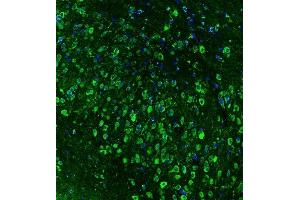IF analysis of HSP90AB1 using anti-HSP90AB1 antibody (ABIN3042462) HSP90AB1 was detected in paraffin-embedded section of mouse brain tissues.