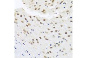 Immunohistochemistry of paraffin-embedded mouse brain using HD antibody (ABIN6128012, ABIN6141669, ABIN6141672 and ABIN6213648) at dilution of 1:100 (40x lens). (HDAC4 抗体  (AA 451-650))