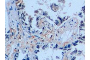 Immunohistochemistry (IHC) image for anti-Stathmin 1 (STMN1) (AA 2-149) antibody (ABIN7435226)