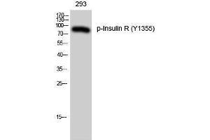 Western Blotting (WB) image for anti-Insulin Receptor (INSR) (pTyr1355) antibody (ABIN3182541) (Insulin Receptor 抗体  (pTyr1355))