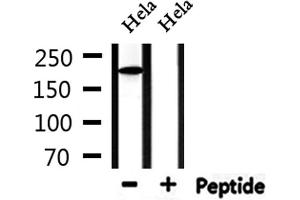 Western blot analysis of extracts from Hela, using Collagen Valpha 1 Antibody. (COL5A1 抗体  (N-Term))