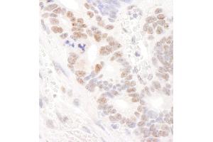 anti-DEAD (Asp-Glu-Ala-Asp) Box Polypeptide 24 (DDX24) (C-Term) antibody