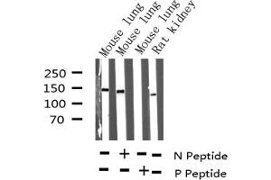 Western blot analysis of Phospho-Met (Tyr1234) expression in various lysates (c-MET 抗体  (pTyr1234))