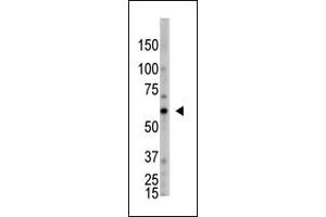 The anti-OASL C-term Antibody (ABIN390168 and ABIN2840664) is used in Western blot to detect OASL in HL60 lysate. (OASL 抗体  (C-Term))