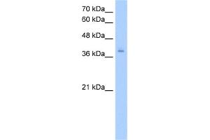 WB Suggested Anti-PCBP2 Antibody Titration:  2. (PCBP2 抗体  (N-Term))