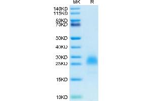 SDS-PAGE (SDS) image for Poliovirus Receptor-Related Immunoglobulin Domain Containing (PVRIG) (AA 41-171) protein (His tag) (ABIN7275503)