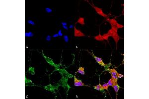 Immunocytochemistry (ICC) image for anti-Transient Receptor Potential Cation Channel, Subfamily C, Member 5 (TRPC5) (AA 827-845) antibody (Atto 594) (ABIN2485371)
