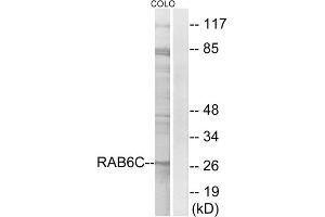 Western blot analysis of extracts from COLO cells, using RAB6C antibody. (WTH3DI 抗体  (Internal Region))