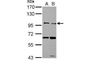WB Image TLR5 antibody detects TLR5 protein by Western blot analysis. (TLR5 抗体  (N-Term))