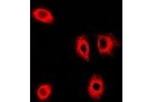 Immunofluorescent analysis of PIST staining in A549 cells. (GOPC 抗体)