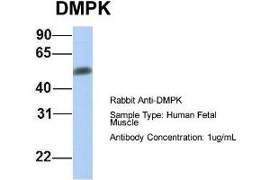 Host:  Rabbit  Target Name:  DMPK  Sample Type:  Human Fetal Muscle  Antibody Dilution:  1. (DMPK 抗体  (Middle Region))