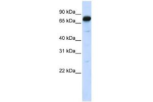WB Suggested Anti-AMOT Antibody Titration:  0.