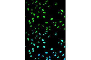 Immunofluorescence analysis of HeLa cell using CDC20 antibody. (CDC20 抗体  (AA 1-270))