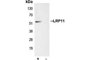 Immunoprecipitation of LRP11 from 0. (LRP11 抗体  (Center))