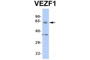 Western Blotting (WB) image for anti-Vascular Endothelial Zinc Finger 1 (VEZF1) (Middle Region) antibody (ABIN2776482)