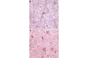 Immunohistochemical analysis of paraffin-embedded human cerebrum (A) and myelencephalon (B) tissue, showing cytoplasmical localization, using DNM2 monoclonal antibody, clone 5E4C2F3  with DAB staining. (DNM2 抗体)