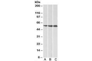 Western blot testing of A) HeLa, B) HepG2 and C) K562 cell lysate using HMGCS1 antibody at 1ug/ml. (HMGCS1 抗体)