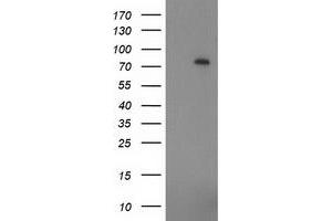 Western Blotting (WB) image for anti-Zinc Finger, Imprinted 2 (ZIM2) (AA 1-150), (AA 428-527) antibody (ABIN1490589) (ZIM2 抗体  (AA 1-150, AA 428-527))
