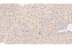 Detection of PCK1 in Mouse Liver Tissue using Polyclonal Antibody to Phosphoenolpyruvate Carboxykinase 1, Soluble (PCK1) (PCK1 抗体  (AA 312-563))