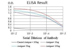 Black line: Control Antigen (100 ng), Purple line: Antigen(10 ng), Blue line: Antigen (50 ng), Red line: Antigen (100 ng), (MSH6 抗体)