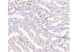 ABIN6267315 at 1/200 staining human kidney tissue sections by IHC-P. (Retinoblastoma 1 抗体  (pSer780))