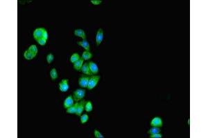 Immunofluorescent analysis of PC-3 cells using ABIN7162107 at dilution of 1:100 and Alexa Fluor 488-congugated AffiniPure Goat Anti-Rabbit IgG(H+L) (SEPSECS 抗体  (AA 5-451))