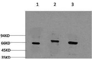 Western Blot analysis of 1) 293T, 2) C2C12, 3) Rat brain using BECN1 Monoclonal Antibody at dilution of 1:2000. (Beclin 1 抗体)