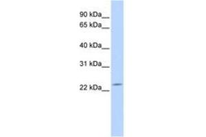 Image no. 1 for anti-Deleted in Primary Ciliary Dyskinesia Homolog (DPCD) (AA 36-85) antibody (ABIN6743816) (DPCD 抗体  (AA 36-85))