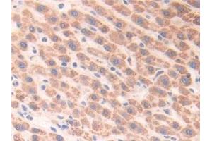Immunohistochemistry (IHC) image for anti-Enoyl Coenzyme A Hydratase 1, Peroxisomal (ECH1) (AA 1-328) antibody (ABIN7443788)