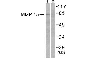 Western blot analysis of extracts from MDA-MB-435 cells, using MMP-15 antibody (ABIN5976459). (MMP15 抗体  (C-Term))